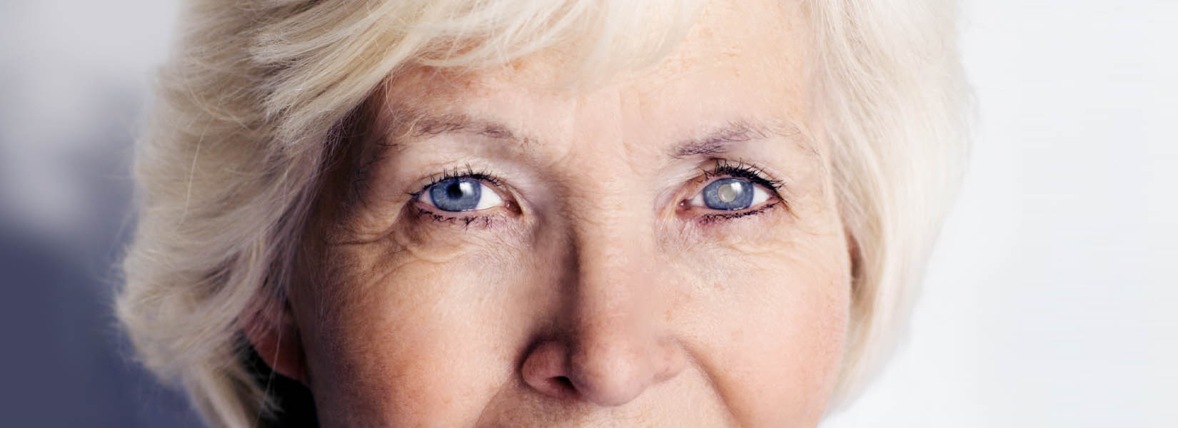 Cataract Surgery in Central Northwest